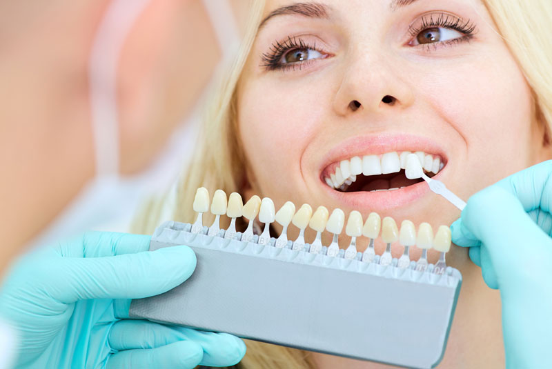 Dental Veneers Patient Receiving Veneers